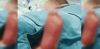 Pais usavam chapinha de cabelo e água quente para torturar bebê