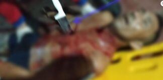 Pescador é encontrado agonizando com faca cravada no peito dentro de uma embarcação