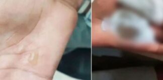 Mãe e madrasta são indiciadas por torturar menino com colher quente