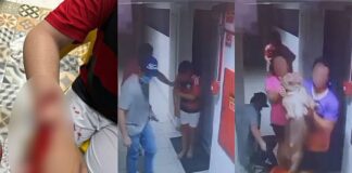 Ataque de pitbull deixa criança ferida em condomínio