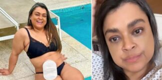 Preta Gil passa por cirurgia para retirar bolsa de ileostomia