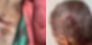 Homem é internado após ser espancado por espiar a vizinha trocar de roupa