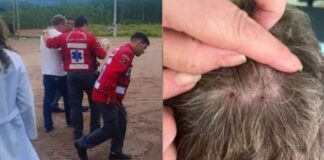 Homem é picado por cobra na cabeça e é hospitalizado em SC