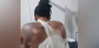 Homem é preso após atear fogo na companheira adolescente durante crise de ciúmes