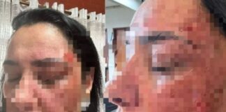 Diretora de Escola Municipal leva pedrada no rosto ao abrir colégio