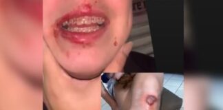 DJ foi agredida por policial ao defender amiga que sofria assédio em festa de carnaval; PM foi afastado