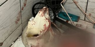 Mulher é internada na UTI após vaso sanitário em que ela estava sentada se quebrar