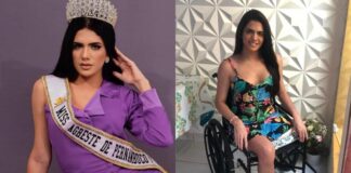 Miss brasileira tem perna amputada após acidente e pede ajuda