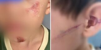 Escola denuncia mãe e madrasta por agressão; crianças chegaram machucadas na instituição