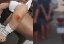 Mãe e bebê de colo são agredidos durante assalto em Aparecida de Goiânia