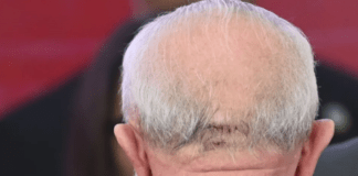 Lula detalha acidente doméstico que causou ferimento na cabeça; veja relato