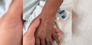 Homem é preso após mutilar dedos de companheira e dar choques por 15 anos