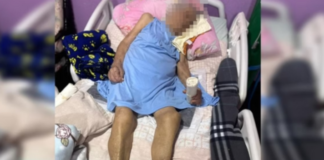 Enfermeira é investigada por amputar pé de idosa de 103 anos sem anestesia e com bisturi ‘cego’