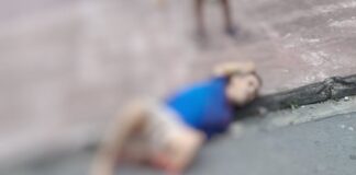 Homem tem perna destruída ao ser atropelado por criminoso em fuga em Manaus