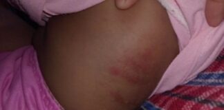 Padrasto espanca enteada de 1 ano; mãe de 16 anos também foi agredida