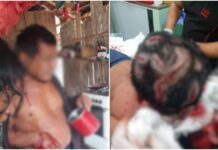 Homem sofre ataque de onça e fica gravemente ferido em Lábrea (AM); veja o vídeo