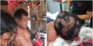 Homem sofre ataque de onça e fica gravemente ferido em Lábrea (AM); veja o vídeo