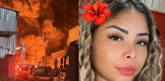 Com 44% do corpo queimado, grávida diz ser grata por estar viva