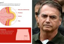 Michelle diz que cirurgia de Bolsonaro foi finalizada ‘com sucesso’