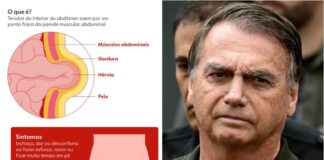 Michelle diz que cirurgia de Bolsonaro foi finalizada ‘com sucesso’