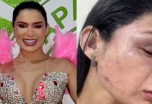 Musa da Aparecida foi espancada por quadrilha que roubava iPhones, diz delegada