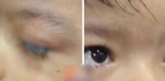 Criança de 2 anos é encontrada com olhos “colados” no Amazonas