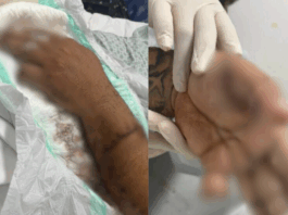 Motorista de aplicativo tem dedo amputado após ataque a terçadadas de passageiro em Manaus