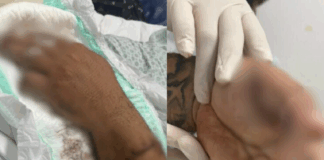 Motorista de aplicativo tem dedo amputado após ataque a terçadadas de passageiro em Manaus