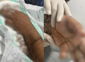 Motorista de aplicativo tem dedo amputado após ataque a terçadadas de passageiro em Manaus