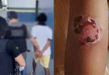 Pai é preso por torturar filhos e causar queimaduras de segundo grau