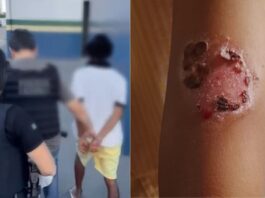 Pai é preso por torturar filhos e causar queimaduras de segundo grau