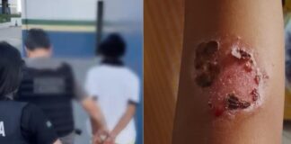 Pai é preso por torturar filhos e causar queimaduras de segundo grau