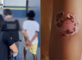 Pai é preso por torturar filhos e causar queimaduras de segundo grau
