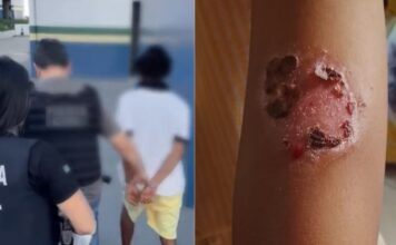 Pai é preso por torturar filhos e causar queimaduras de segundo grau